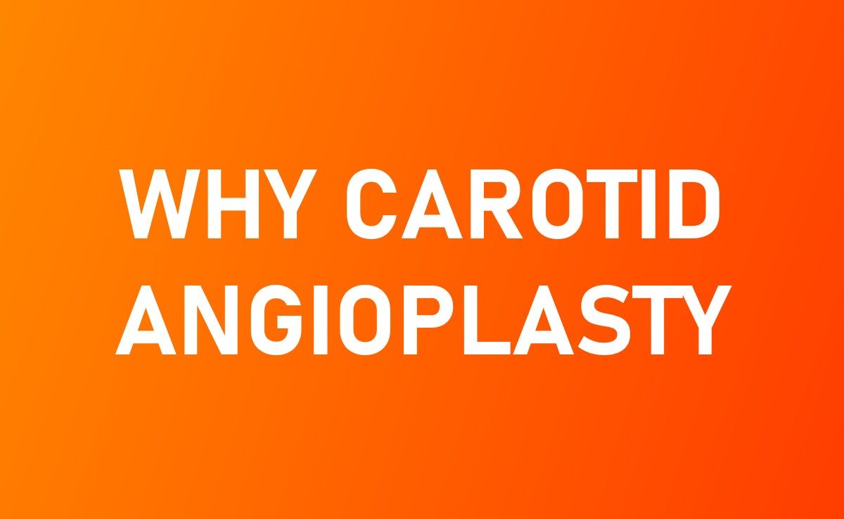 carotid_angioplasty