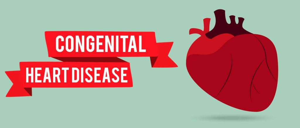 Congenital Heart Disease in Adults | Knowing Risks & Treatments